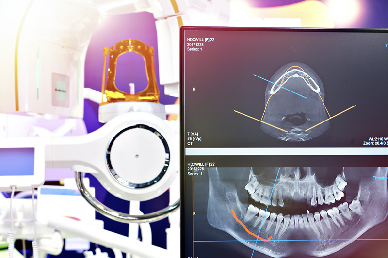 Digital X-Rays in West Grove