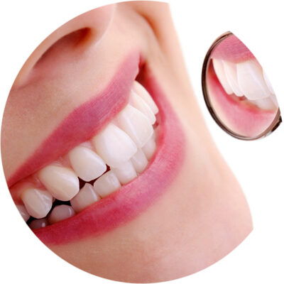 Cosmetic Dentistry photo